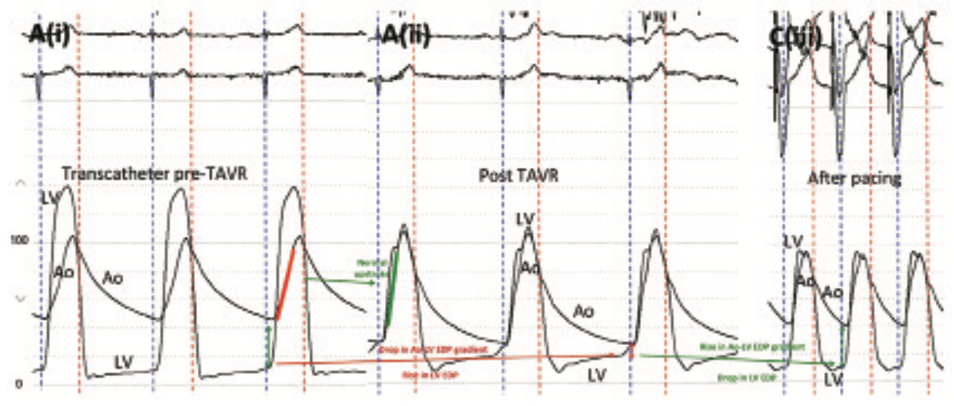 Kern Hemodynamics Figure 10
