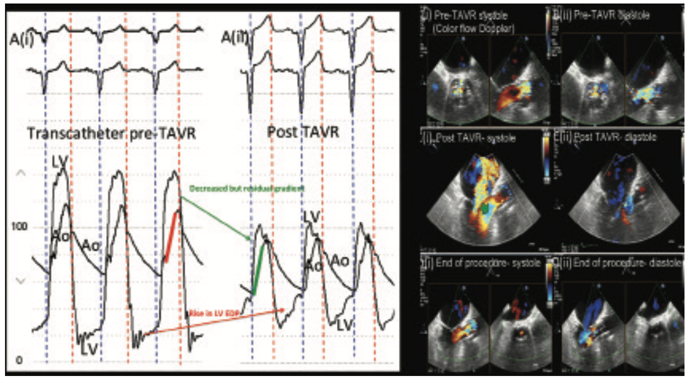 Kern Hemodynamics Figure 12