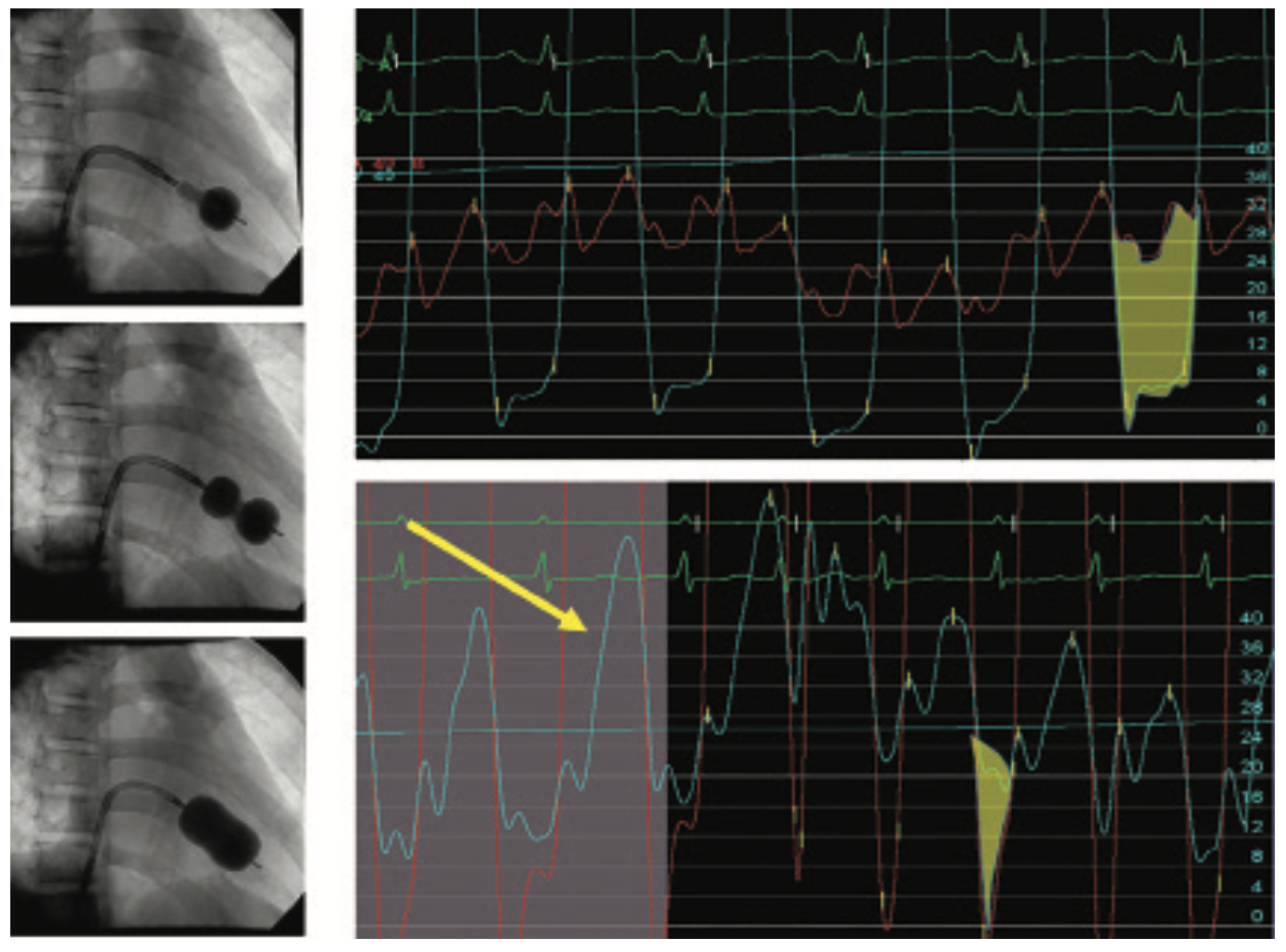 Kern Hemodynamics Figure 13