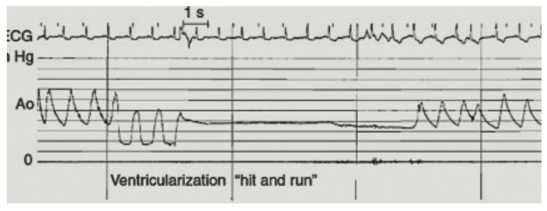 Kern Hemodynamics Figure 2