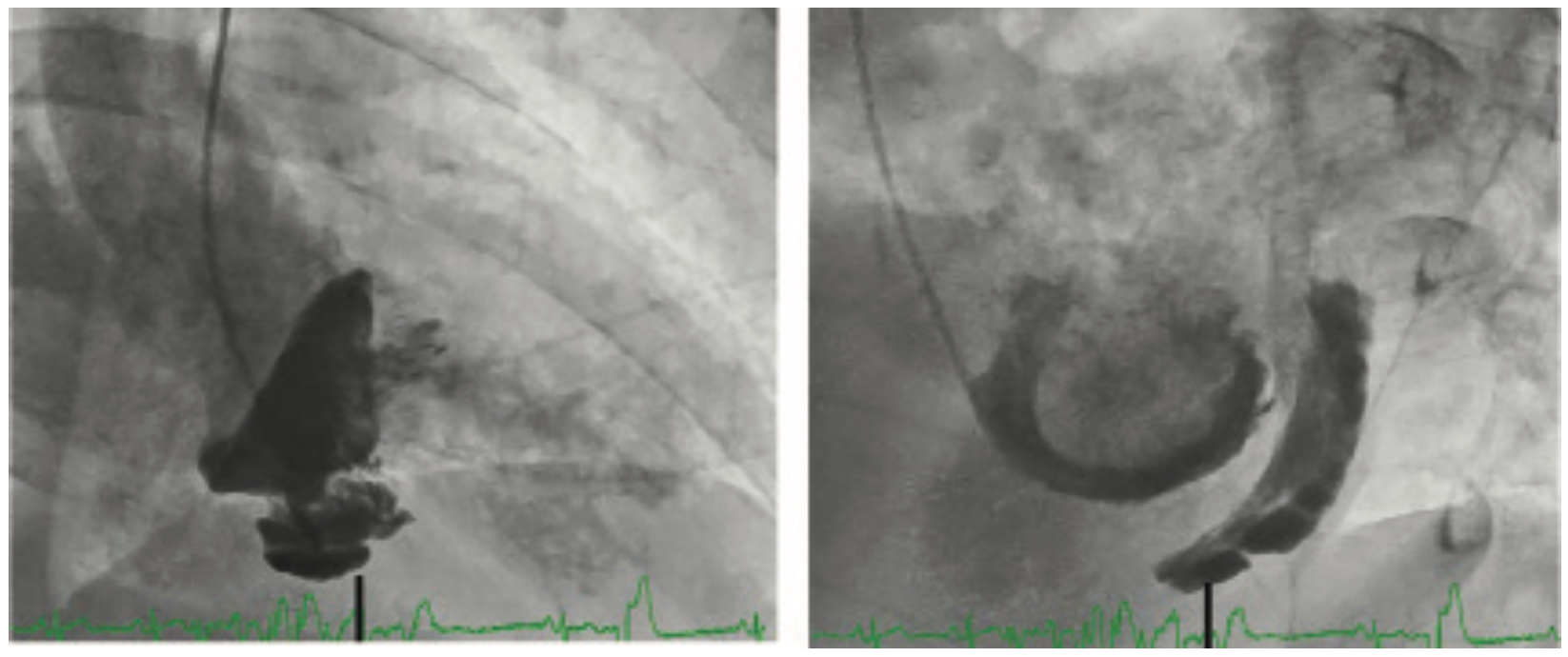 Kern Hemodynamics Figure 3