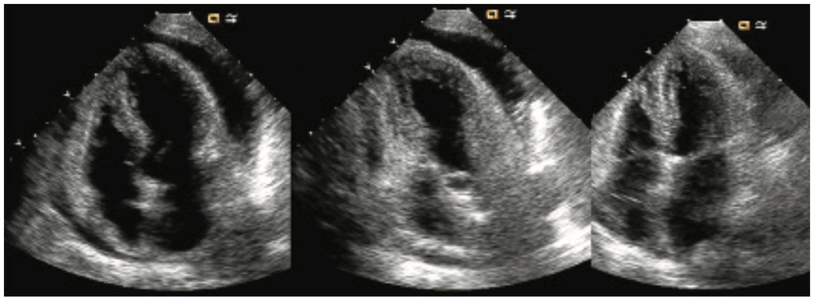 Kern Hemodynamics Figure 5