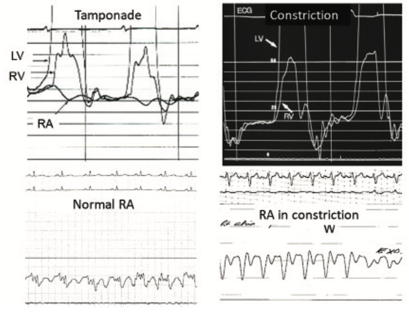 Kern Hemodynamics Figure 7