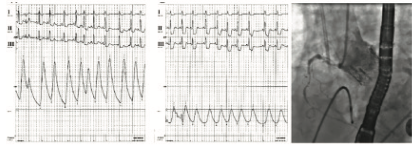 Kern Hemodynamics Figure 8