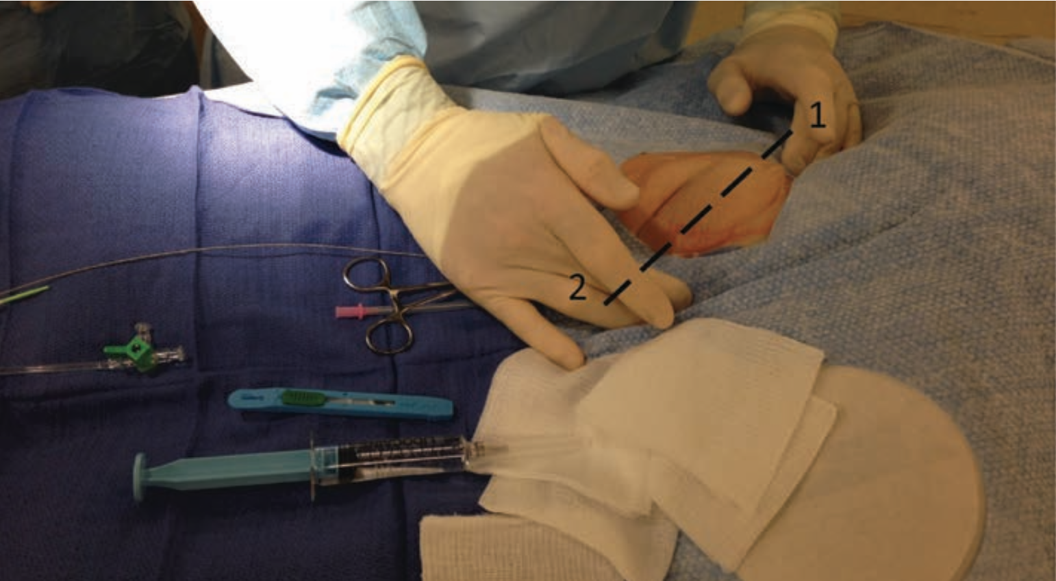 Kern Hemostasis Figure 1B