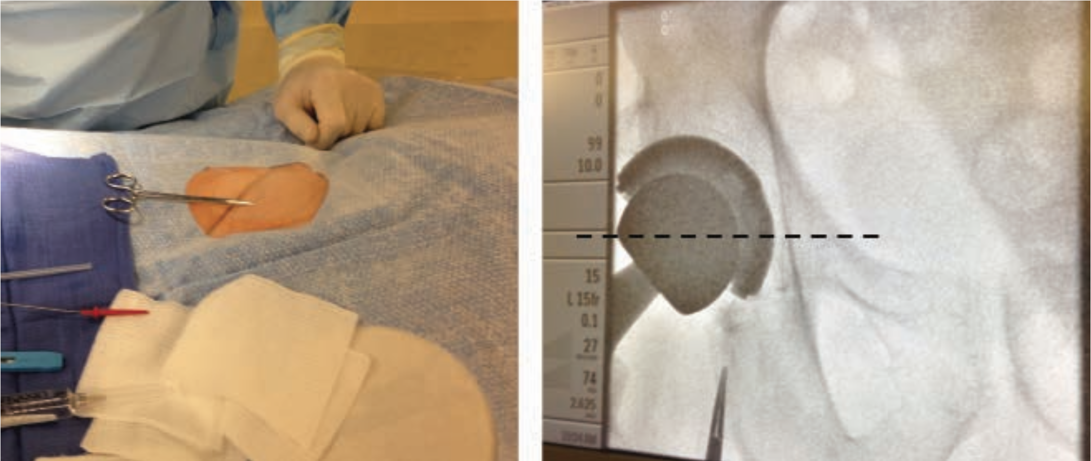 Kern Hemostasis Figure 3