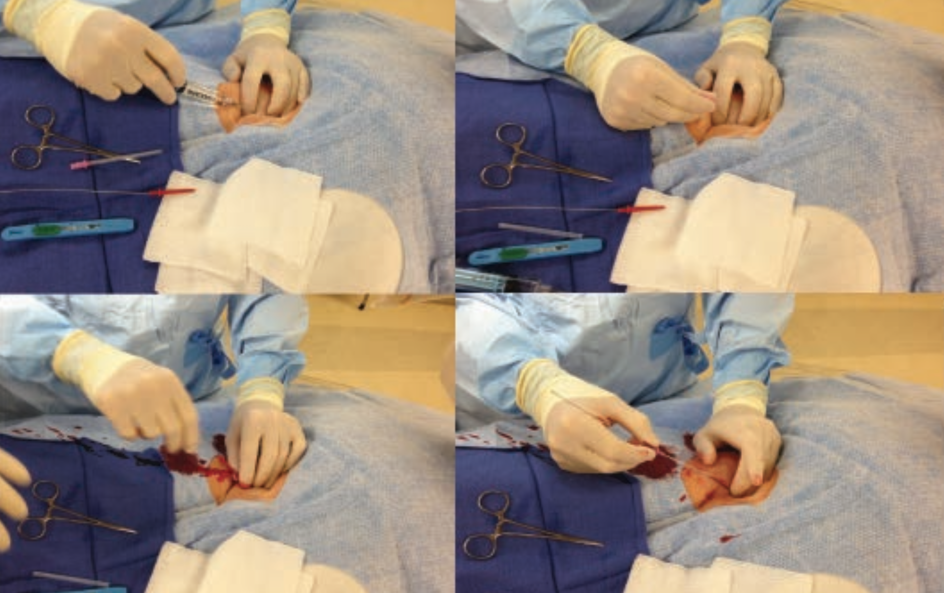 Kern Hemostasis Figure 4