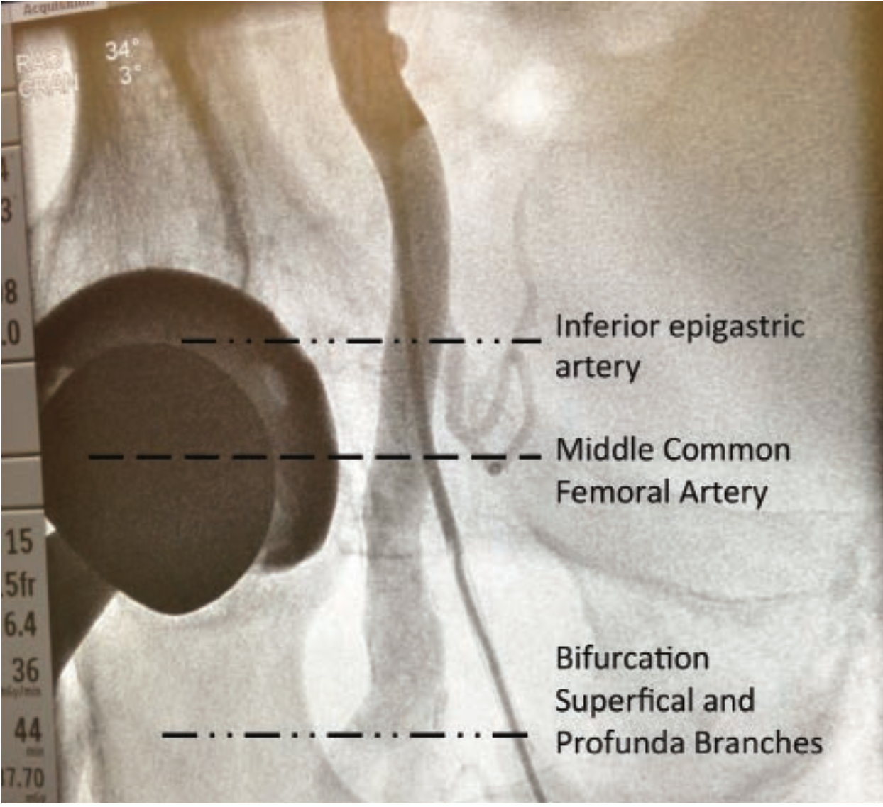 Kern Hemostasis Figure 6