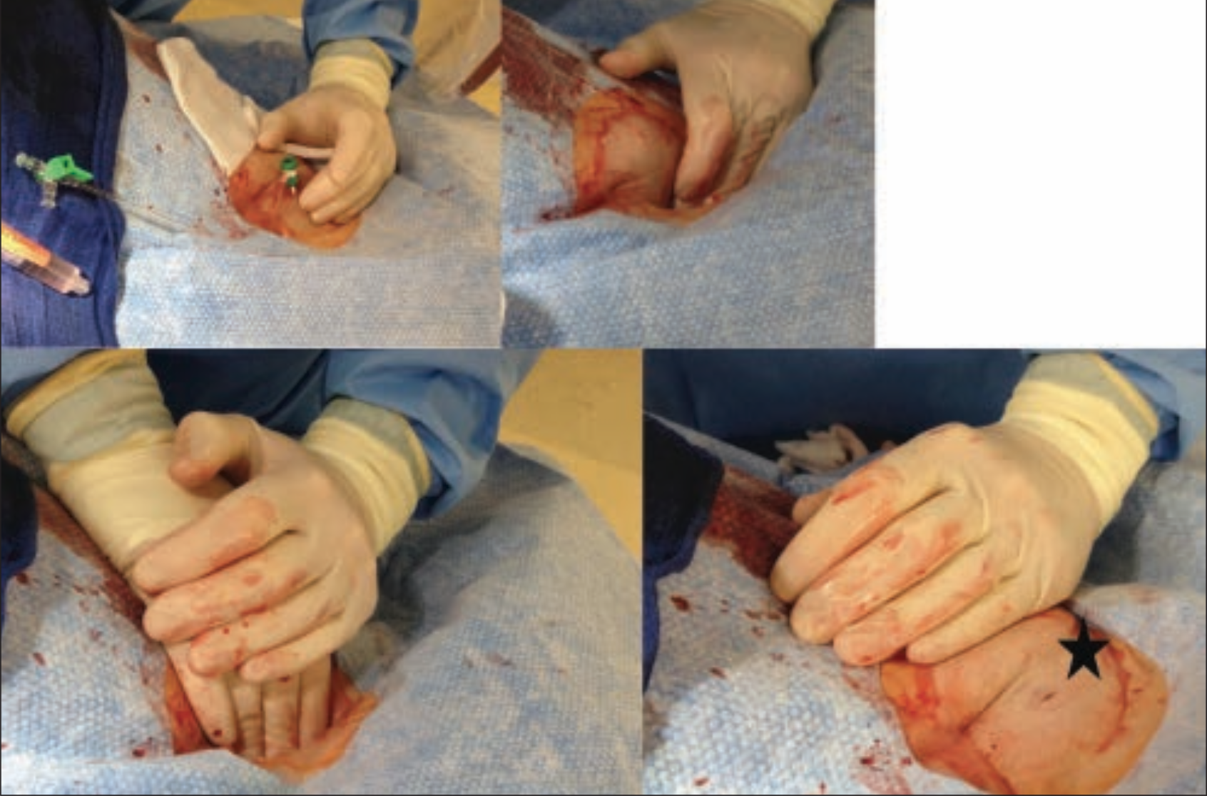 Kern Hemostasis Figure 7