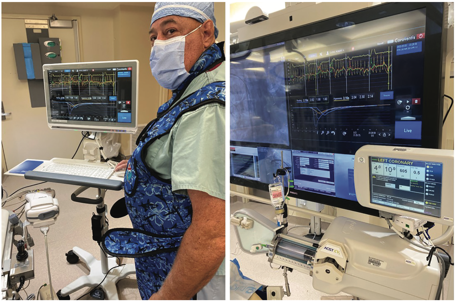 Kern INOCA Figure 4A