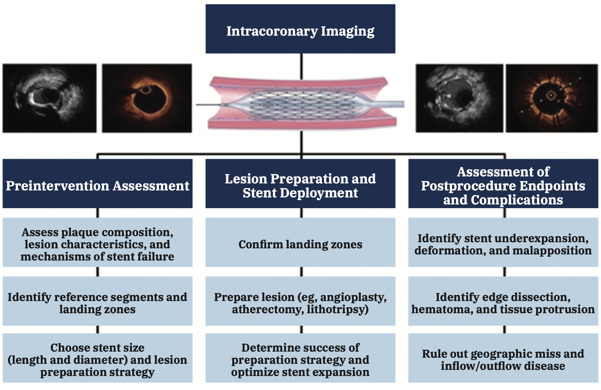 Kern Intravascular Imaging Figure