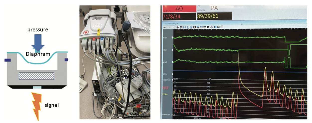 Kern Langston Figure 2
