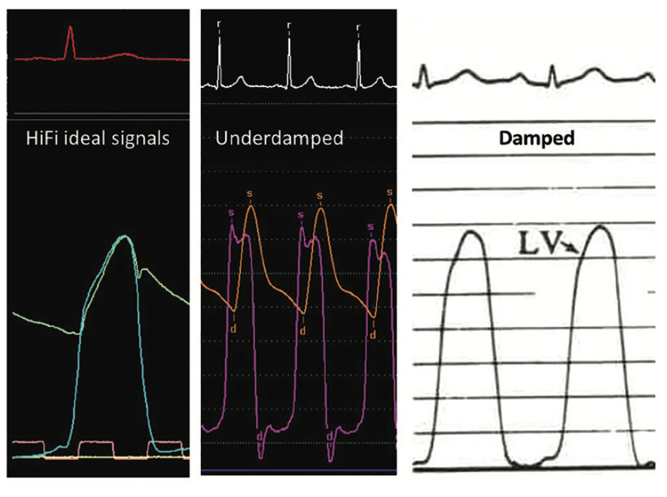 Kern Langston Figure 3