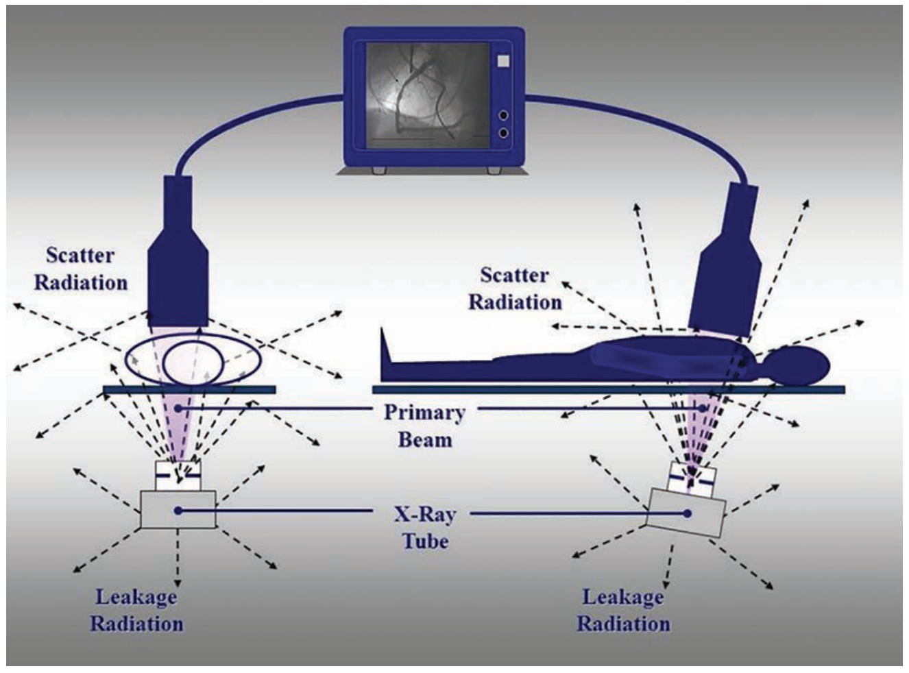 Kern Lead-Free Figure 2