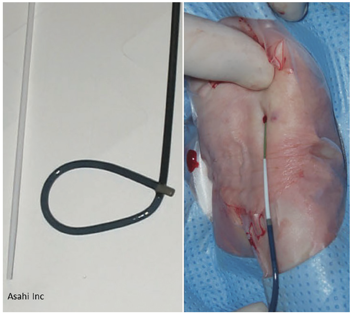 Kern Radial Sheath Figure 1