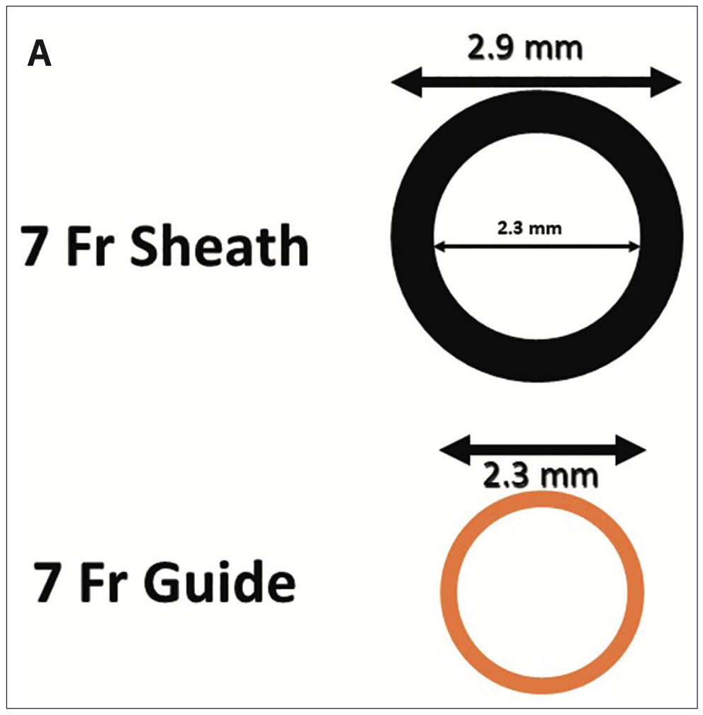 Kern Radial Sheath Figure 2A