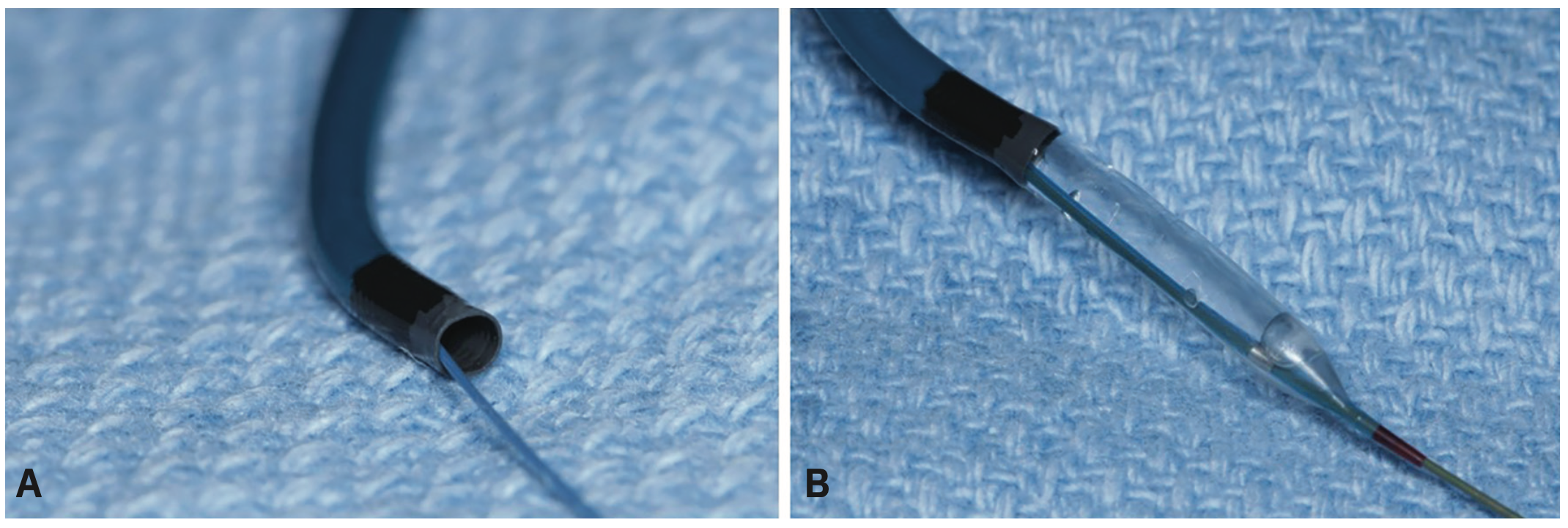 Kern Radial Sheath Figure 3