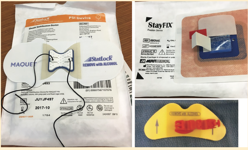 Kern Radial Sheath Figure 5