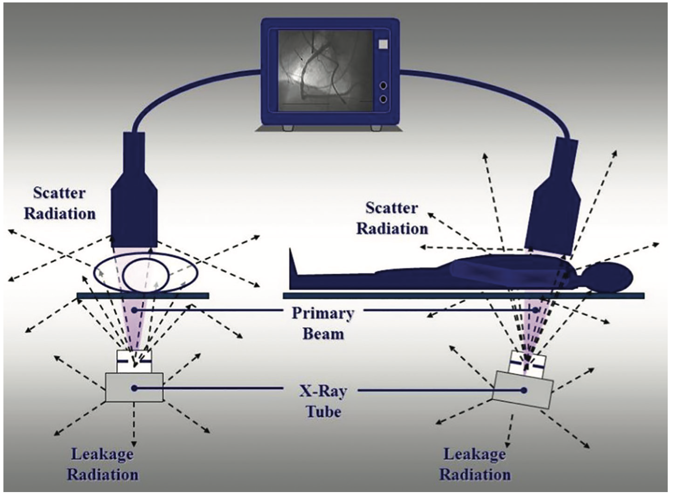 Kern Radiation Figure 1A