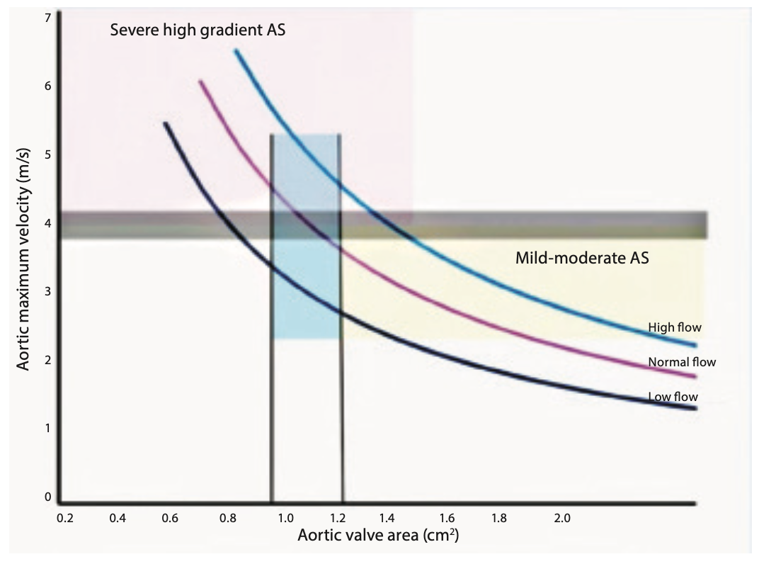 Kern Severe AS Figure 1