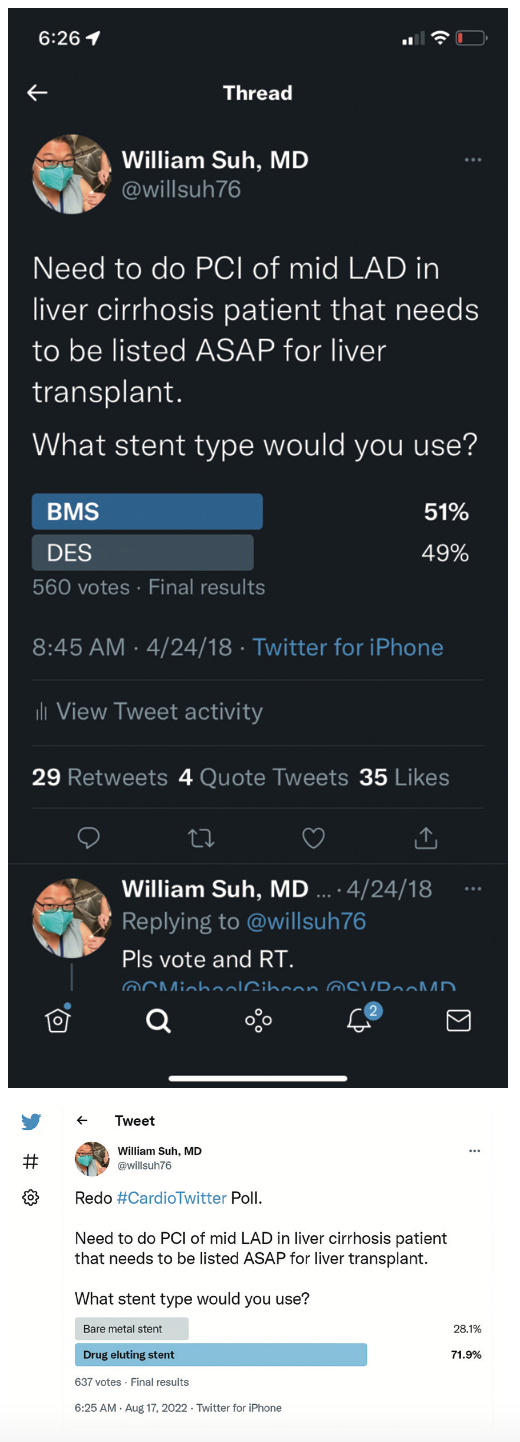 Kern Stents Figure 1