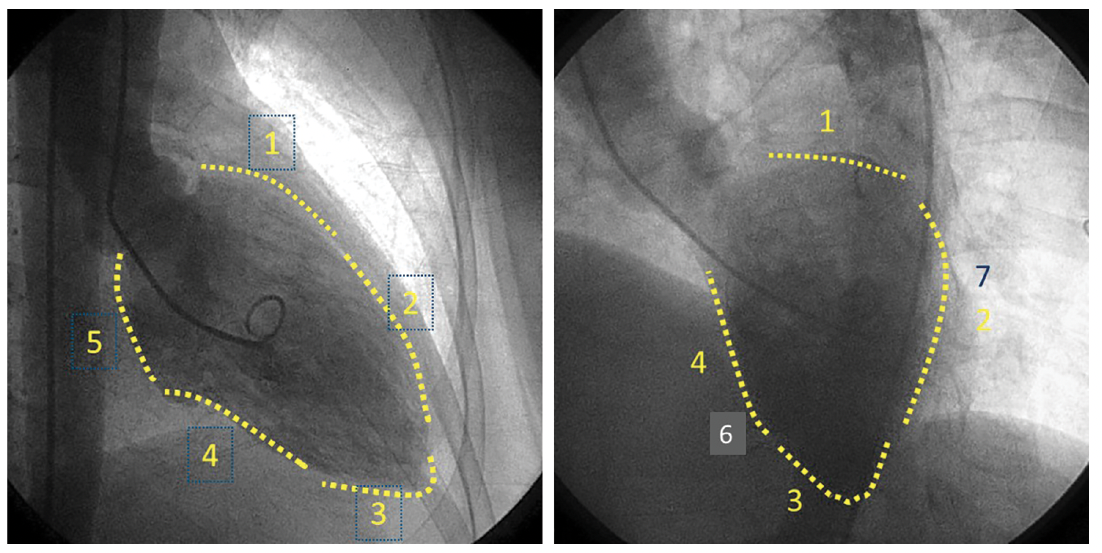 Kern CLD Figure 11 August 2023