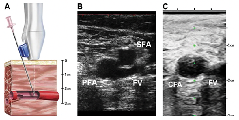 Kern Figure 6 August 2023 CLD