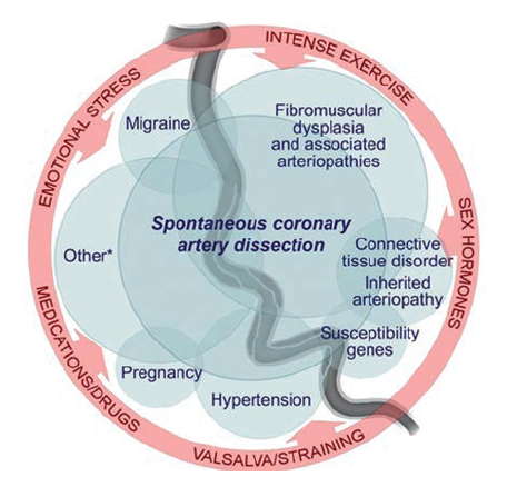 Figure 7. SCAD and associated conditions.
