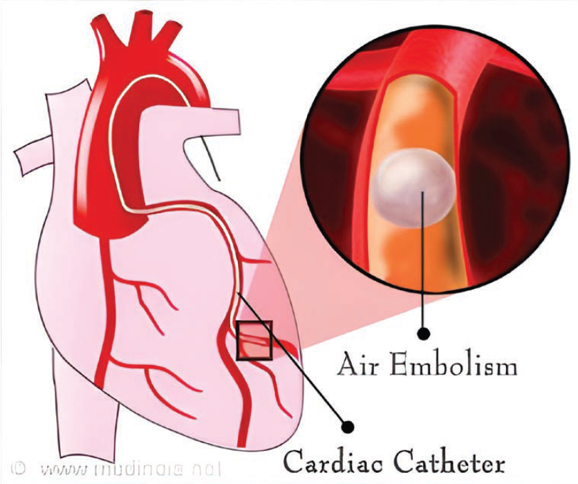 Kern-Fig1-CLD-Aug 2025.png 