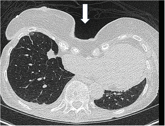 Kern-Fig1-CLD-MarchApril 2026_0.png 