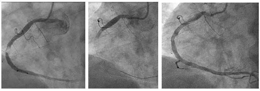 Kern-Fig1-CLD-SeptOct 2026.png 