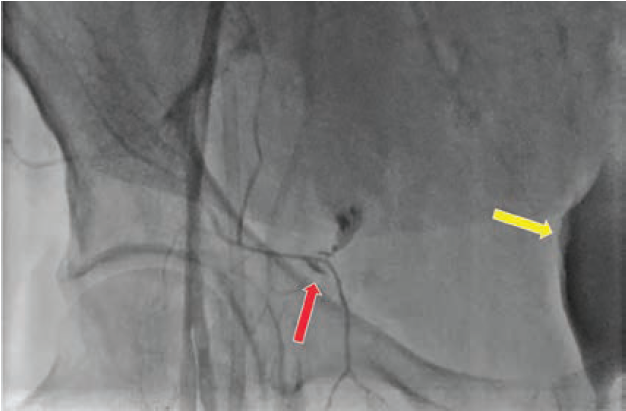 Kern-Fig2-CLD-Dec2024