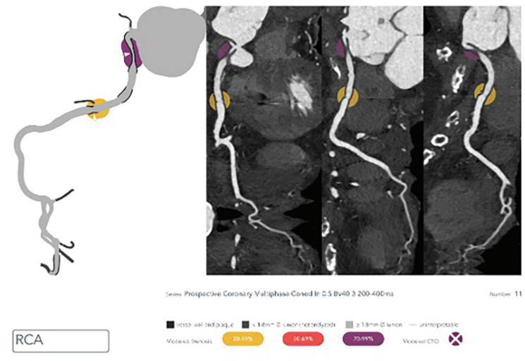 Kern-Fig2-CLD-MarchApril 2026_0.png 