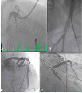 Kern-Fig2-CLD-SeptOct 2026.png 