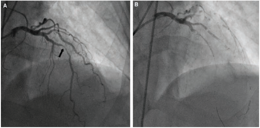 Kern-Fig3-CLD-Aug 2025.png 