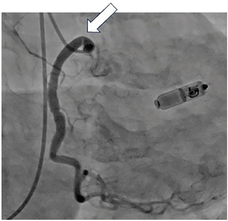 Kern-Fig3-CLD-MarchApril 2026_0.png 