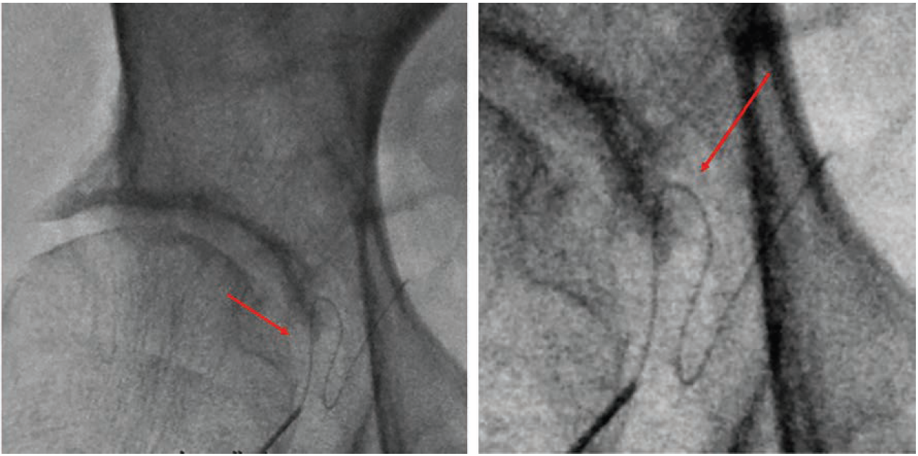 Kern-Fig5-CLD-Dec2024