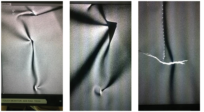 Kern Figure 1 lead aprons