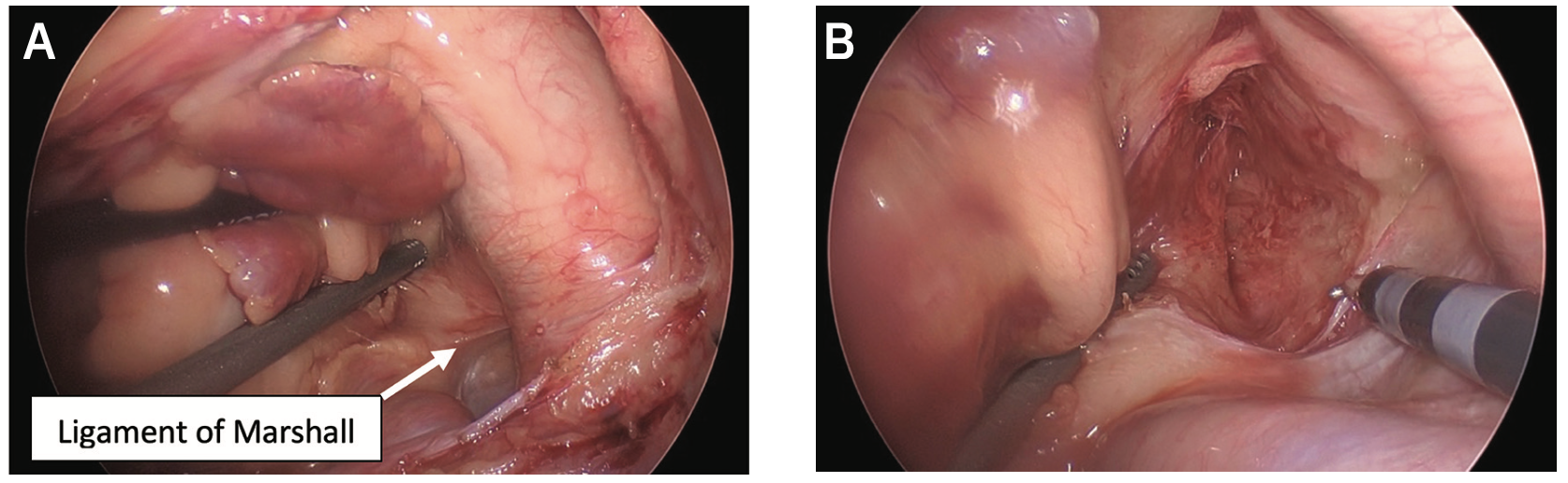 Kiankhooy Convergent “Plus” Figure 5