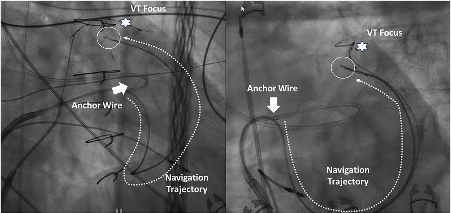 Knight-Fig1-Dec 2025.png 