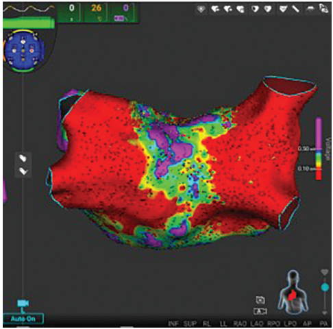Knight-Fig1-EPLD-April 2026