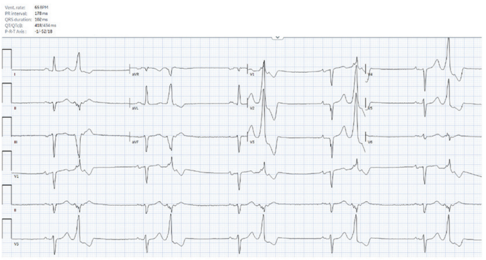 Knight-fig1-EPLD-Nov 2025.png 