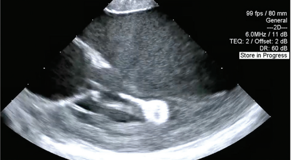 Knight-fig2-EPLD-Nov 2025.png 