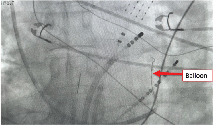 Koranne - Fig 2 - May 2024
