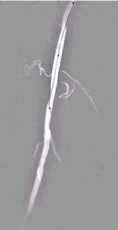 Kumar-Fig 3- CLD-Aug 2025.png 