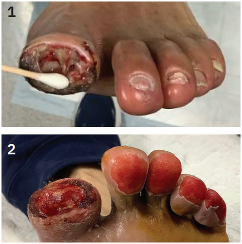 Kumar-Fig1&2-CLD-MarchApril 2026.png 