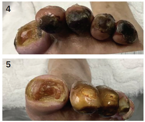 Kumar-Fig4&5-CLD-MarchApril 2026.png 