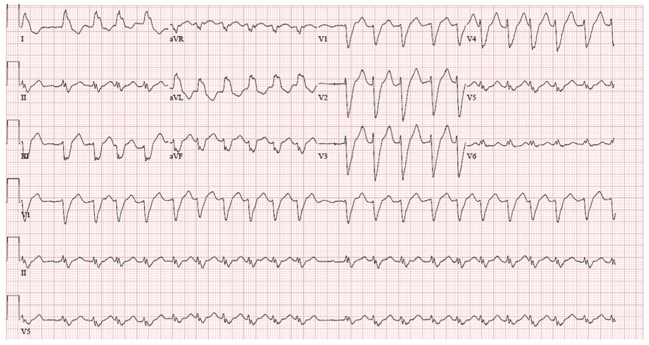 Kwaku Implantable Device Figure 1