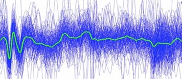 How a Simple Headset Can Solve the Triage Problem in Stroke
