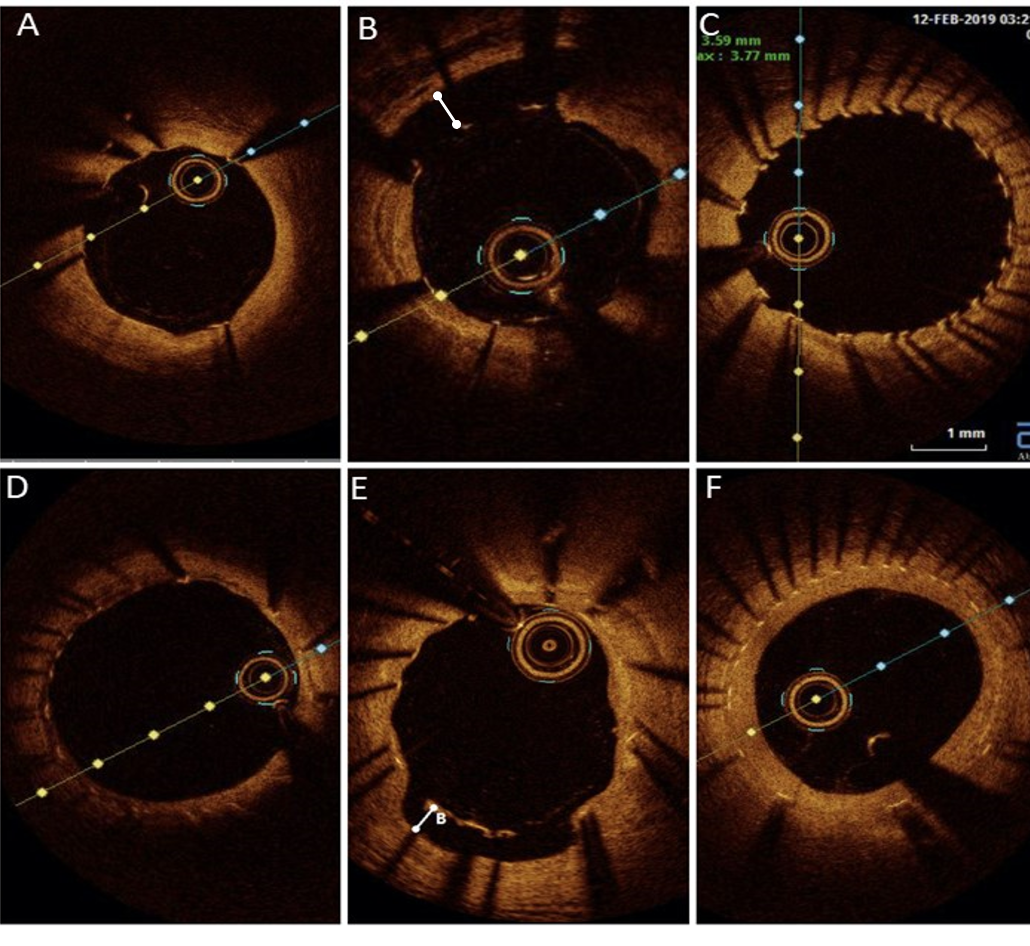 Figure 2. Imaging with optical coherence tomography